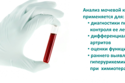 Анализ мочевой кислоты